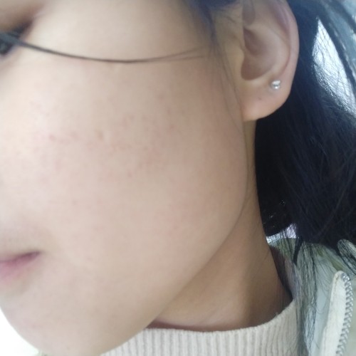 益膚醫(yī)用冷敷貼面膜怎么樣好不好，真實使用體驗(敏感肌必備)
